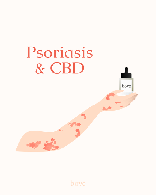 Aceite de CBD para el tratamiento de la psoriasis